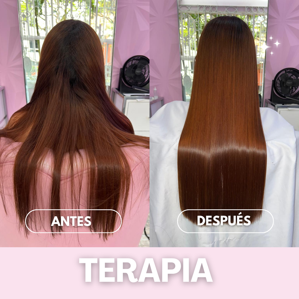 TERAPIA CAPILAR